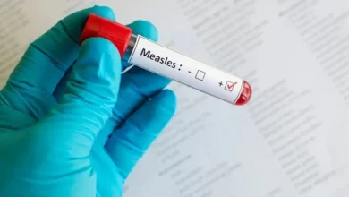Gauteng Launches Mass Measles-Rubella Vaccination Campaign to Protect Children