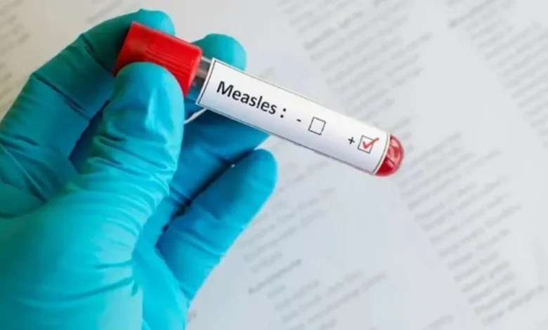Gauteng Launches Mass Measles-Rubella Vaccination Campaign to Protect Children
